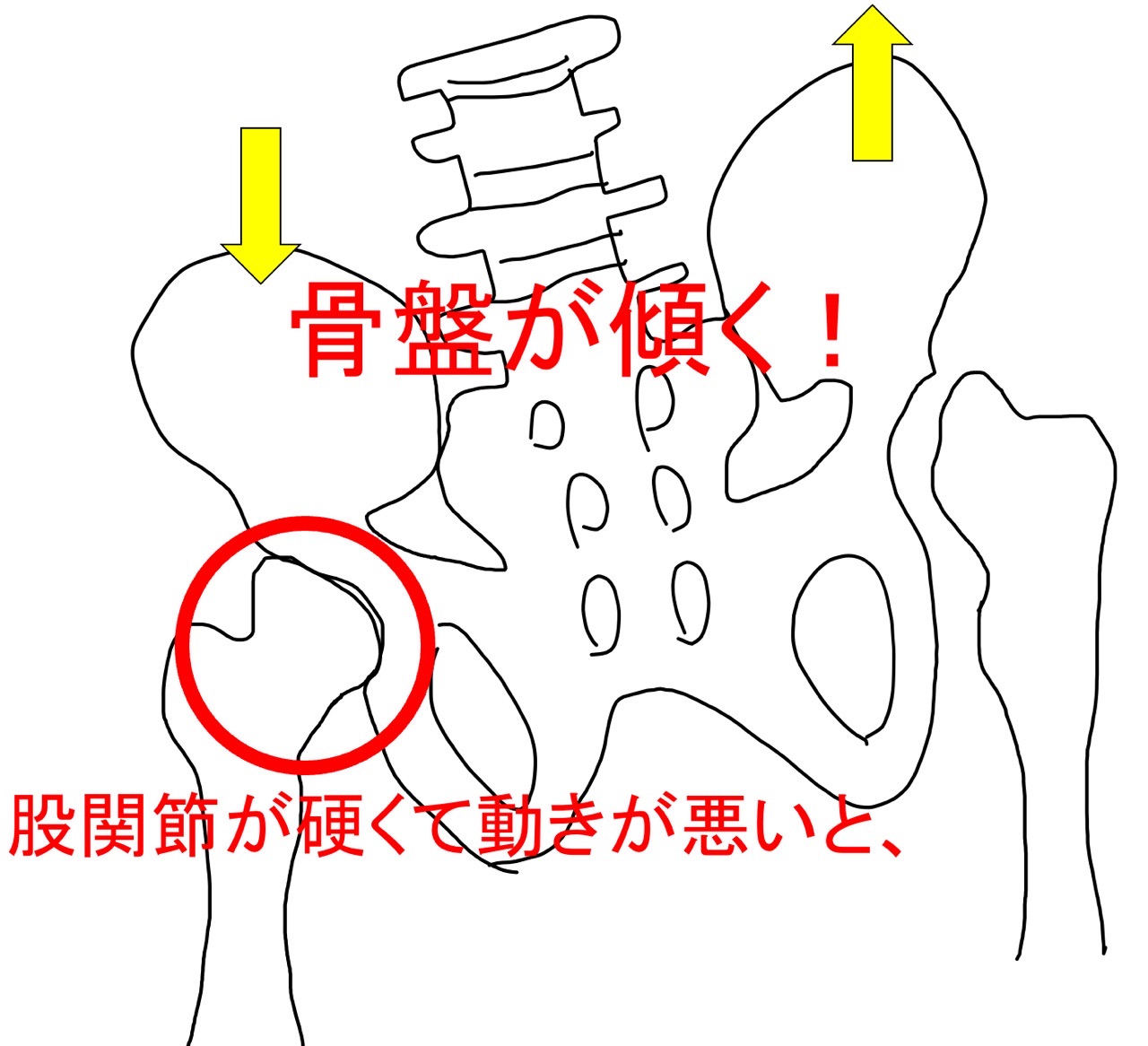 股関節と骨盤の関係