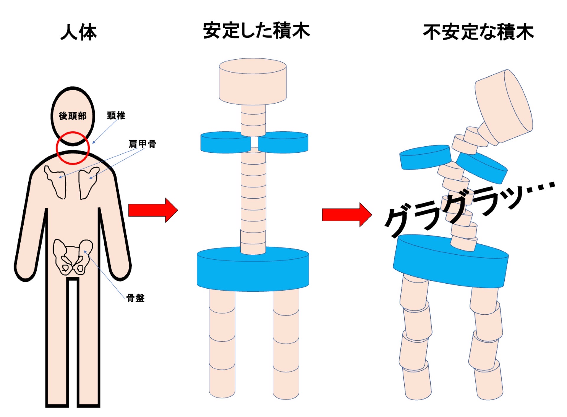 人体を積木に例える