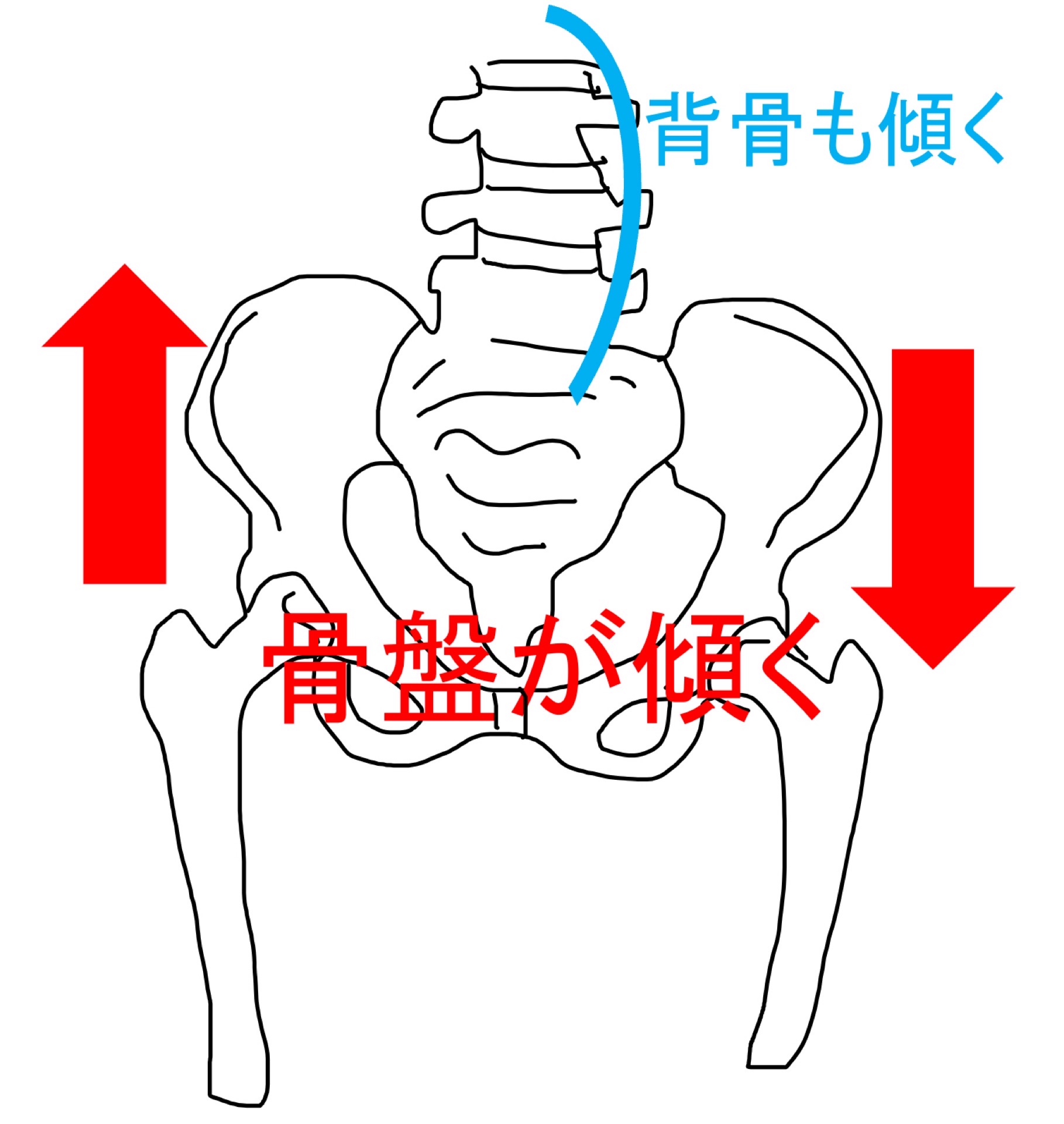 腰椎と骨盤の不安定性