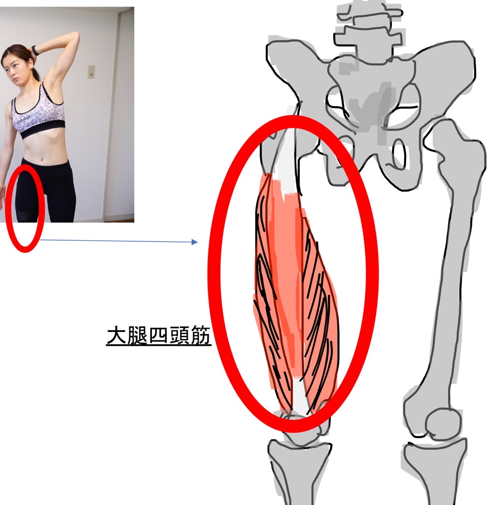 大腿四頭筋