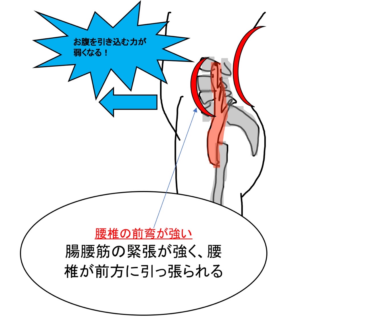 腰椎の前弯が大きい