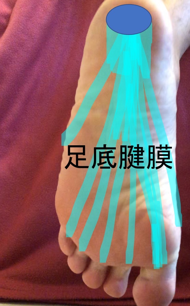 足底腱膜