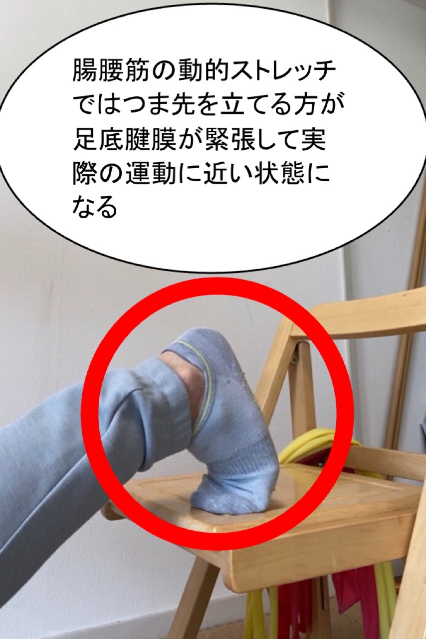 足底腱膜が緊張した状態