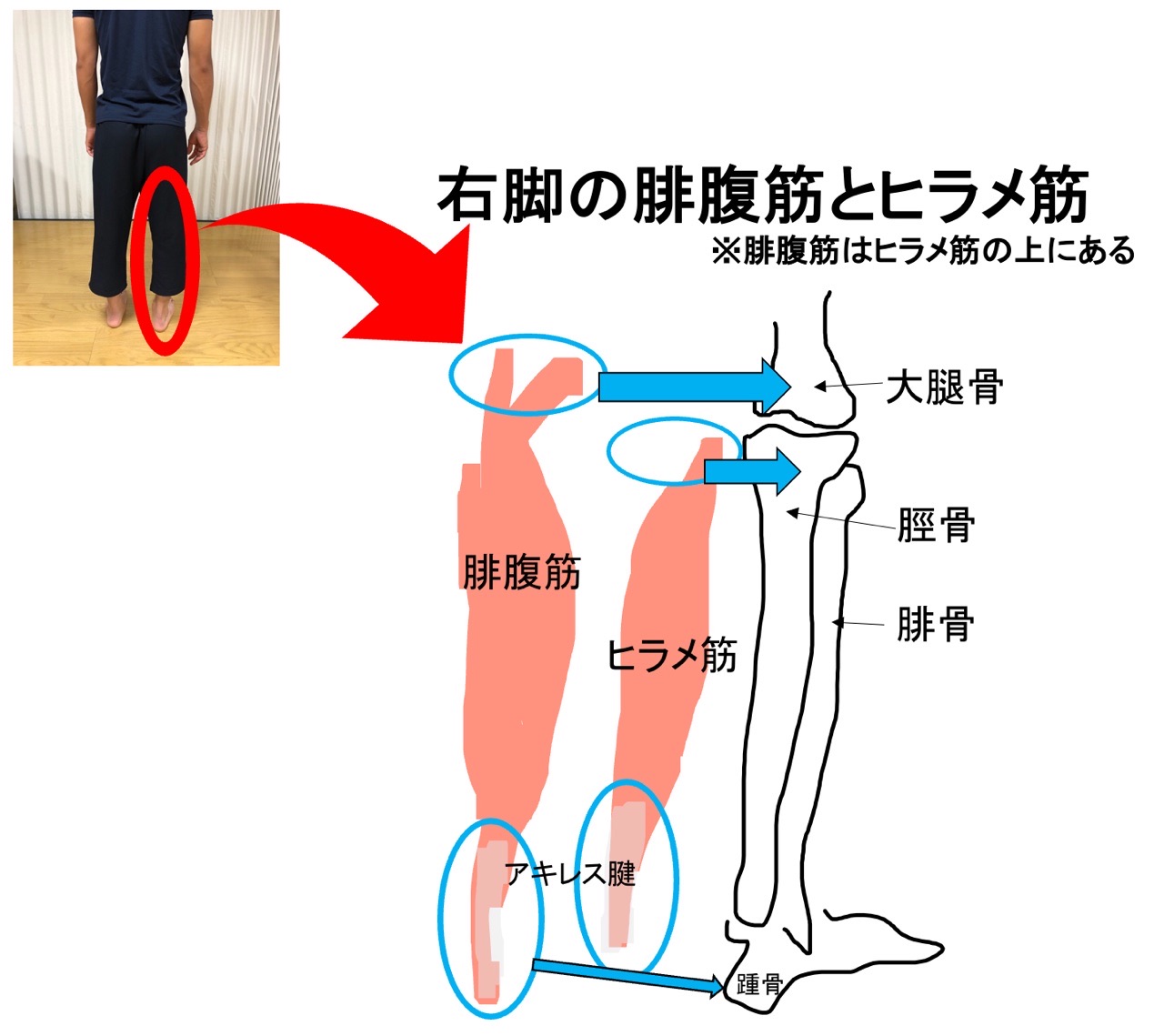 腓腹筋とヒラメ筋