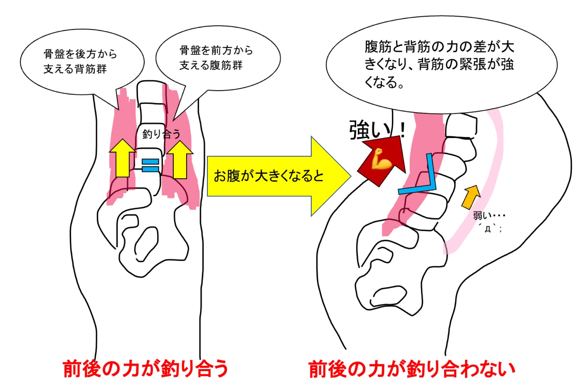 腹筋と背筋の筋力差