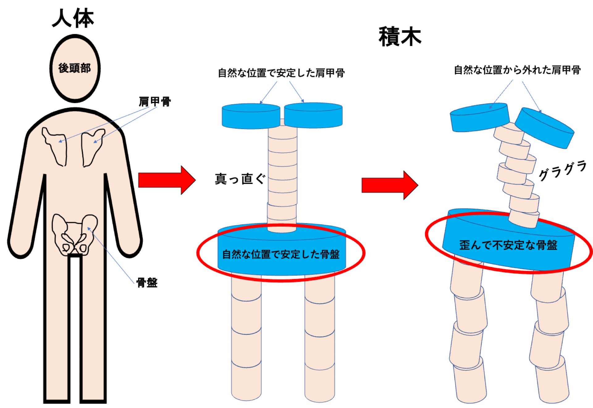 人体を積木に例える