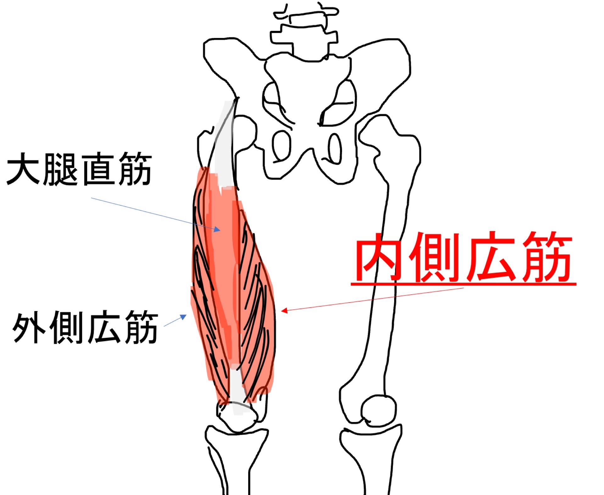 内側広筋