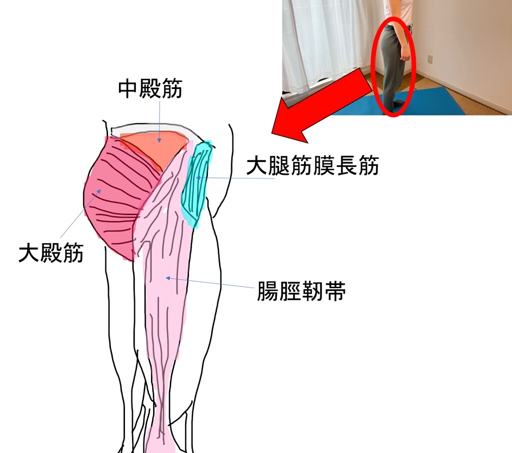 大腿筋膜長筋