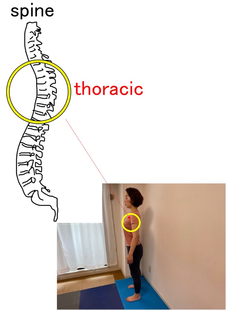 thoracic