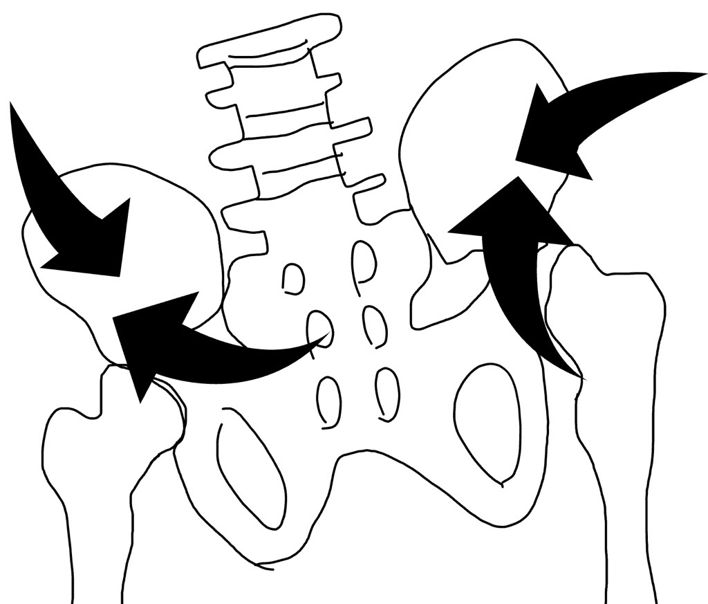 骨盤の歪み
